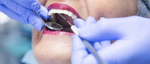 Best Weekend Emergency Dentist in Lincoln, IL
